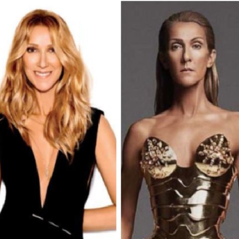 Η Celine Dion: «Κάνει ό, τι μπορεί για να αναρρώσει» σύμφωνα με την αδελφή της