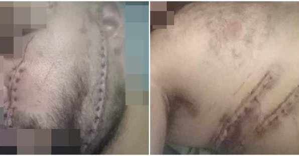 Ανεξάρτητο ποινικό ανακριτή ζητά ο υπόδικος που μαχαιρώθηκε στις Φυλακές-Επιστολή σε Εισαγγελέα