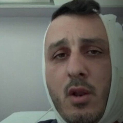«Μου δάγκωσε το αυτί, φώναζε ‘είμαι Χαμάς’»-Άγρια συμπλοκή μεταξύ Ισραηλινού και Σύρου στην Ελλάδα «Μου δάγκωσε το αυτί, φώναζε ‘είμαι Χαμάς’»-Άγρια συμπλοκή μεταξύ Ισραηλινού και Σύρου στην Ελλάδα