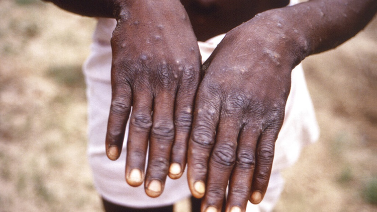 31912_cdc.jpg