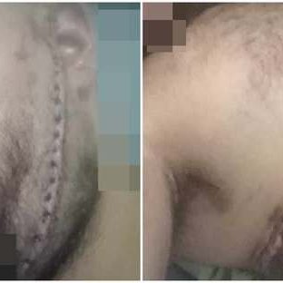 Ανεξάρτητο ποινικό ανακριτή ζητά ο υπόδικος που μαχαιρώθηκε στις Φυλακές-Επιστολή σε Εισαγγελέα