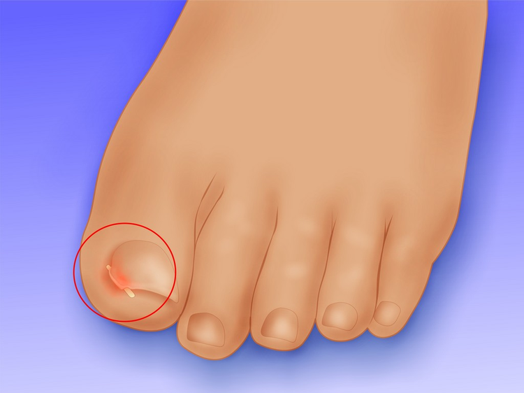08f20caf-1edf-4f76-b39f-dd0aa78cfe7a.jpg