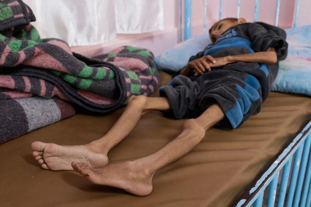 2025-05-01T111333Z_166312823_RC2X8EA586ZT_RTRMADP_5_ISRAEL-PALESTINIANS-GAZA-PATIENTS-CHILDREN